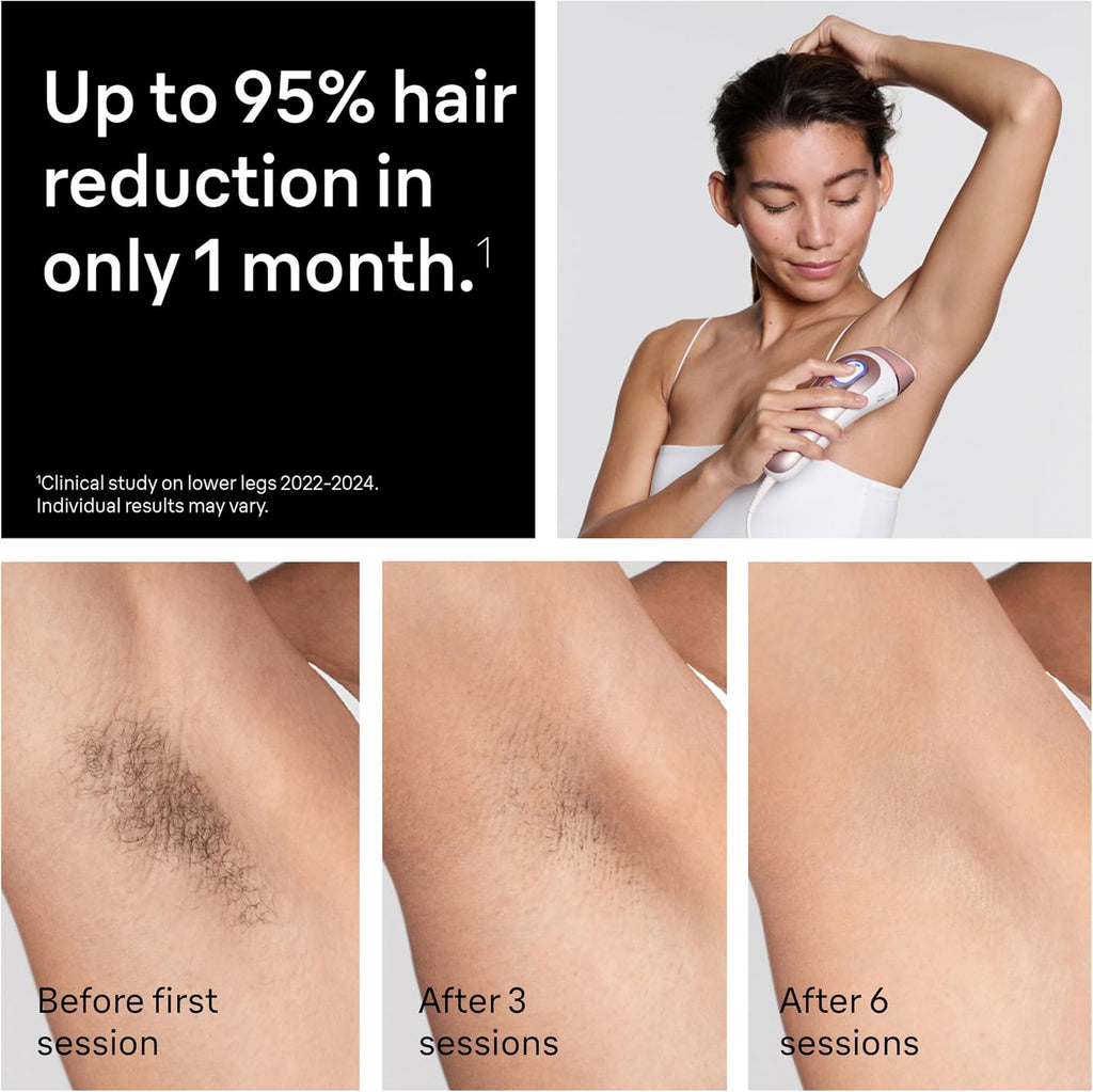 Braun Smart IPL, Skin i·Expert Pro 7, VOGUE's Best Hair Removal Device, IPL Hair Removal for Women and Men, Permanent Laser Hair Reduction At-Home, World's 1st Smart App, 4 Heads, IPL7387